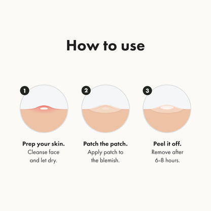 Mighty Patch Original from Hero Cosmetics - Hydrocolloid Acne Pimple Patch for Zits and Blemishes, Spot Treatment Stickers for Face and Skin, Vegan and Cruelty Free (36 Count)